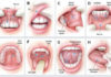 Oral Diseases platform