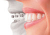 Orthodontics platform