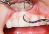 Periodontics platform