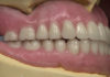 Removable Prosthodontics platform