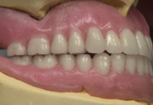 Removable Prosthodontics platform