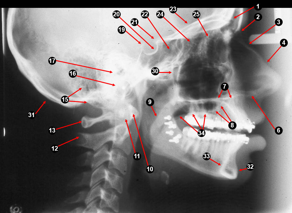 ceph lateral1