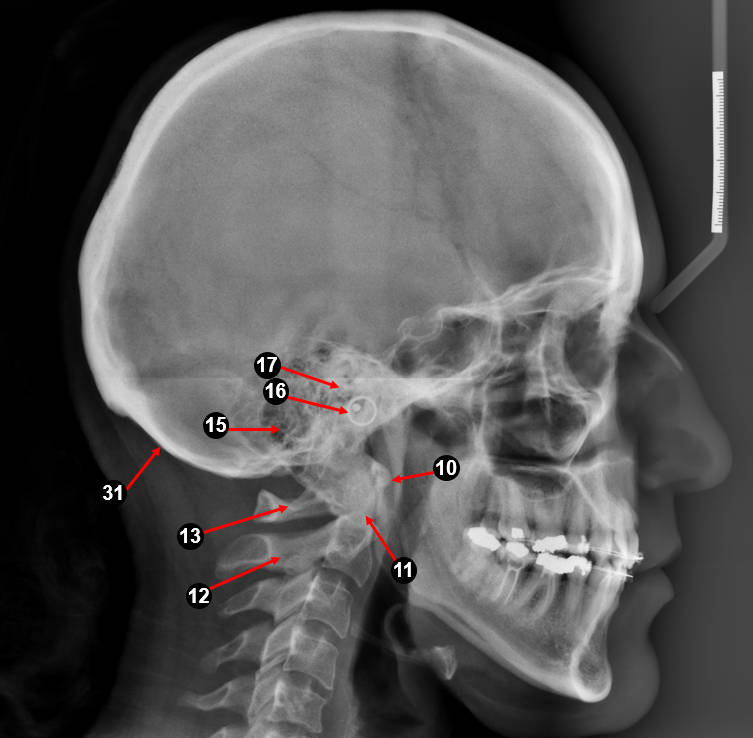 ceph lateral3