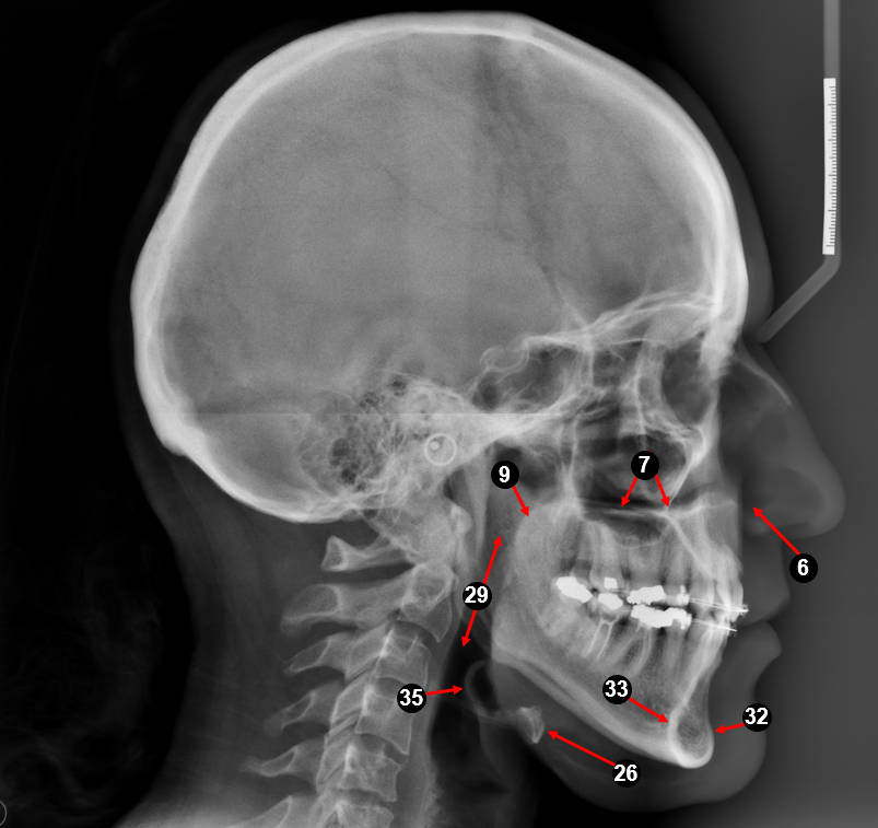 ceph lateral4