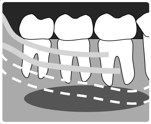 man-molar01