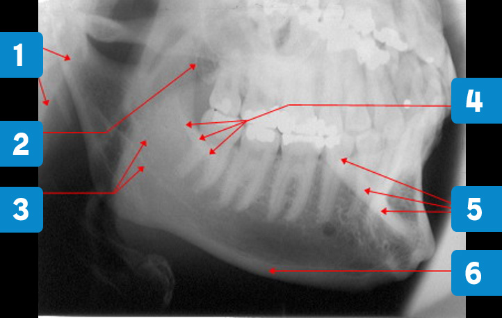 oblique-lateral-2