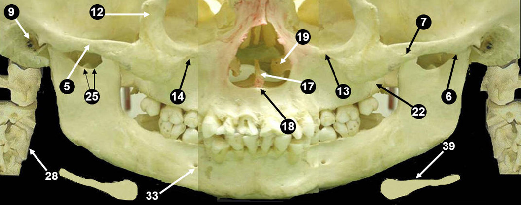 panoramic-bone1