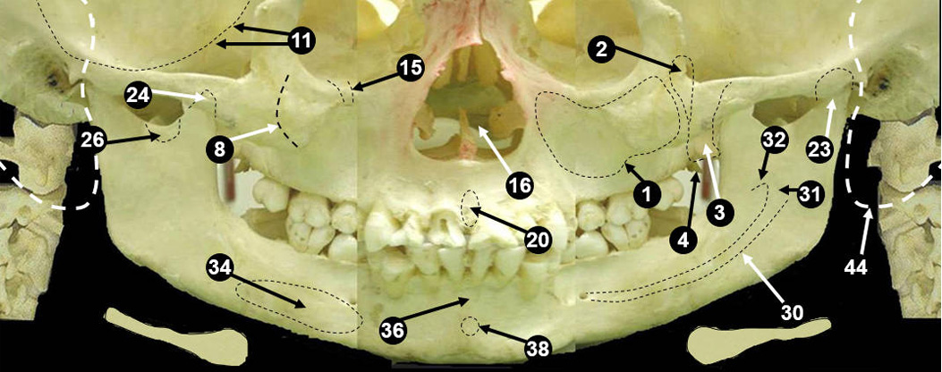 panoramic-bone2