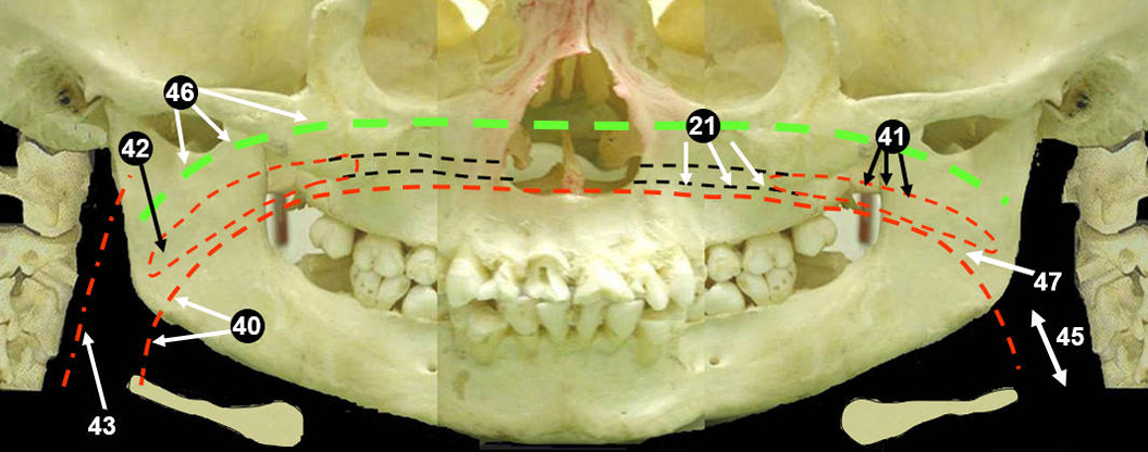 panoramic-bone3