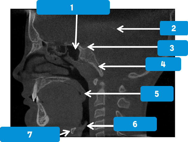 sagittal-1