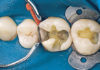 Operative dentistry - Dentistry online