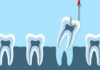 Oral Surgery - Dentistry online