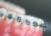 Orthodontics - Dentistry online