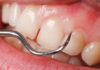 Periodontics - Dentistry online