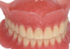 Removable Prosthodontics - Dentistry online