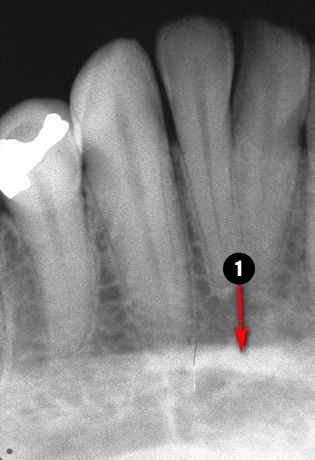 mandibular-canine1q